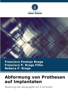 Abformung von Prothesen auf Implantaten - Francisco Pantoja Braga, Francisco P Braga Filho, Rebeca P Braga