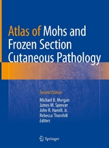 Atlas of Mohs and Frozen Section Cutaneous Pathology - 