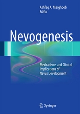 Nevogenesis - 