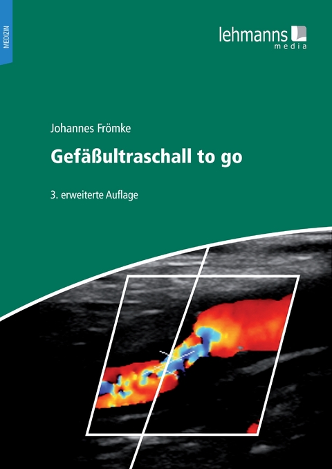 Gefäßultraschall to go - Johannes Frömke