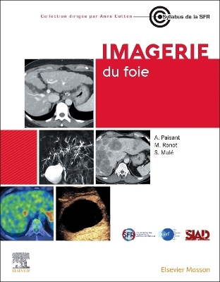 Imagerie du foie - Anita Paisant, Sébastien Mulé, Maxime Ronot