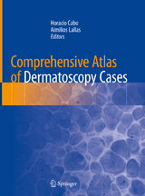 Comprehensive Atlas of Dermatoscopy Cases - 