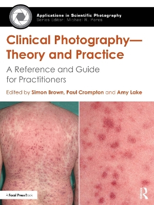 Clinical Photography — Theory and Practice - 