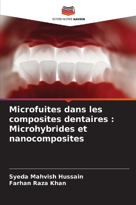 Microfuites dans les composites dentaires - Syeda Mahvish Hussain, Farhan Raza Khan