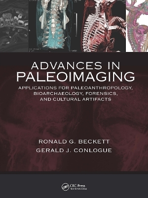 Advances in Paleoimaging - Gerald J. Conlogue, Ronald G. Beckett