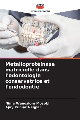 Métalloprotéinase matricielle dans l'odontologie conservatrice et l'endodontie - Nima Wangziom Mosobi, AJAY KUMAR NAGPAL