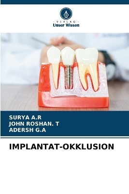 Implantat-Okklusion - Surya A R, John Roshan T, Adersh G a