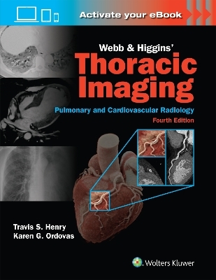 Webb & Higgins Thoracic Imaging: Print + eBook with Multimedia - Travis Henry, KAREN GOMES ORDOVAS