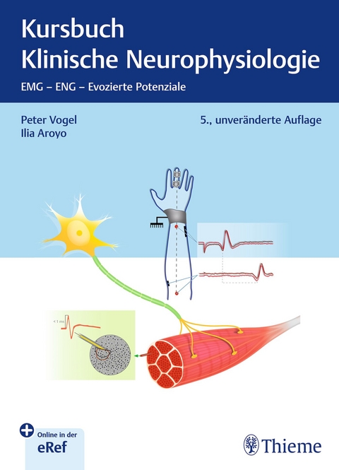 Kursbuch Klinische Neurophysiologie - Peter Vogel, Ilia Aroyo