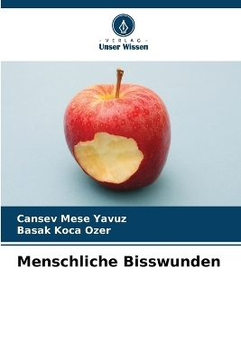 Menschliche Bisswunden - Cansev Mese Yavuz, Başak Koca �zer