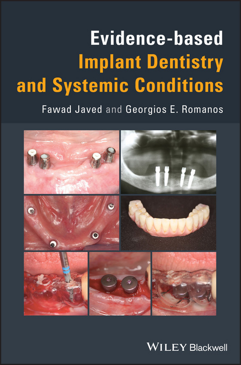 Evidence-based Implant Dentistry and Systemic Conditions - Fawad Javed, Georgios E. Romanos