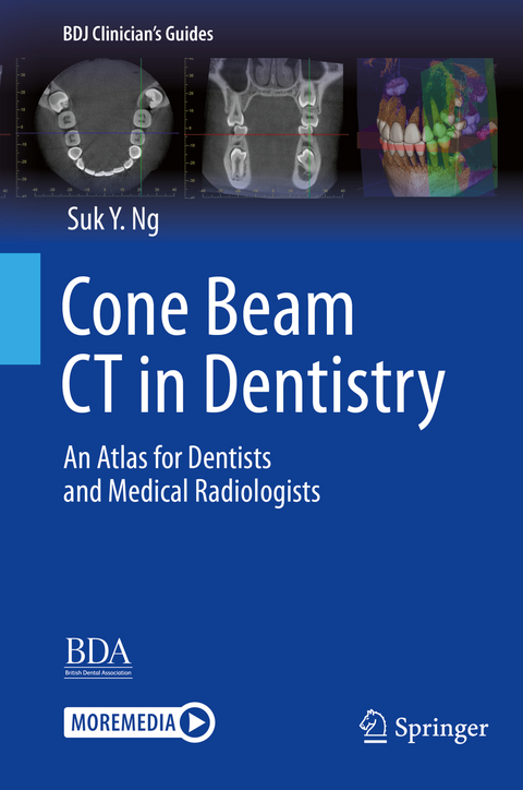 Cone Beam CT in Dentistry - Suk Y. Ng