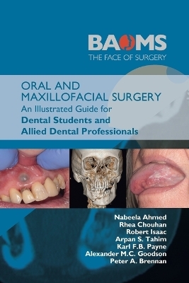 Oral and Maxillofacial Surgery - Nabeela Ahmed, Rhea Chouhan, Robert Isaac