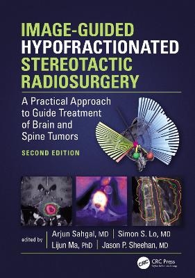 Image-Guided Hypofractionated Stereotactic Radiosurgery - 