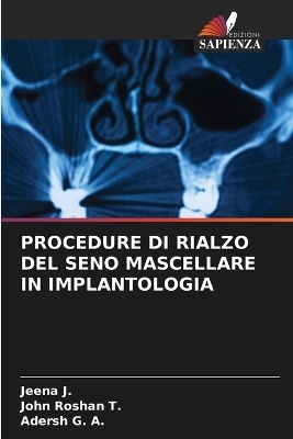 Procedure Di Rialzo del Seno Mascellare in Implantologia - Jeena J, John Roshan T, Adersh G a