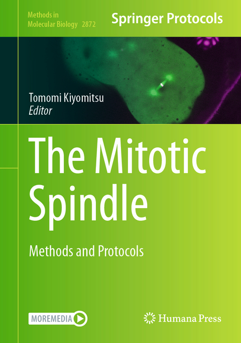 The Mitotic Spindle - 