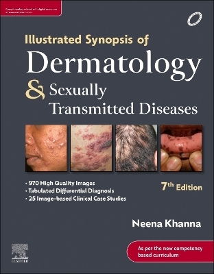 Illustrated Synopsis of Dermatology and Sexually Transmitted Diseases - Neena Khanna