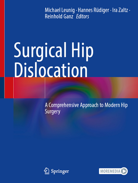 Surgical Hip Dislocation - 