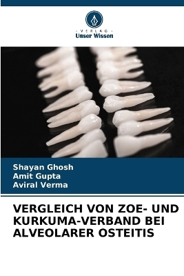 Vergleich Von Zoe- Und Kurkuma-Verband Bei Alveolarer Osteitis - Shayan Ghosh, Amit Gupta, Aviral Verma