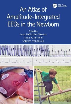 An Atlas of Amplitude-Integrated EEGs in the Newborn - 