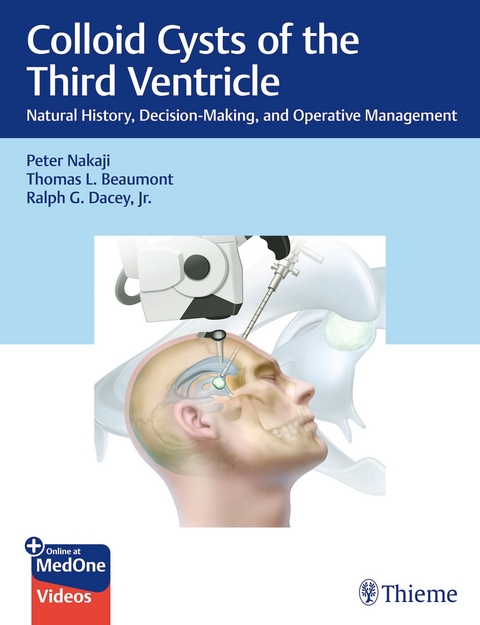 Colloid Cysts of the Third Ventricle - Peter Nakaji, Thomas Beaumont, Jr. Dacey  Ralph