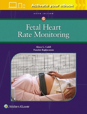 Fetal Heart Rate Monitoring - Alison Cahill, Nandini Raghuraman