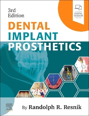 Dental Implant Prosthetics - Randolph Resnik