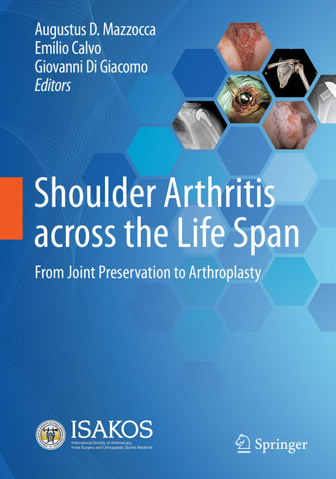 Shoulder Arthritis across the Life Span - 