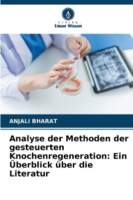 Analyse der Methoden der gesteuerten Knochenregeneration - ANJALI BHARAT