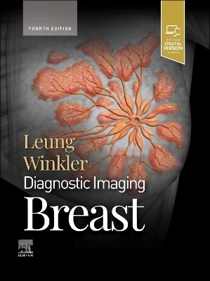 Diagnostic Imaging: Breast - Jessica Leung, Nicole S. Winkler