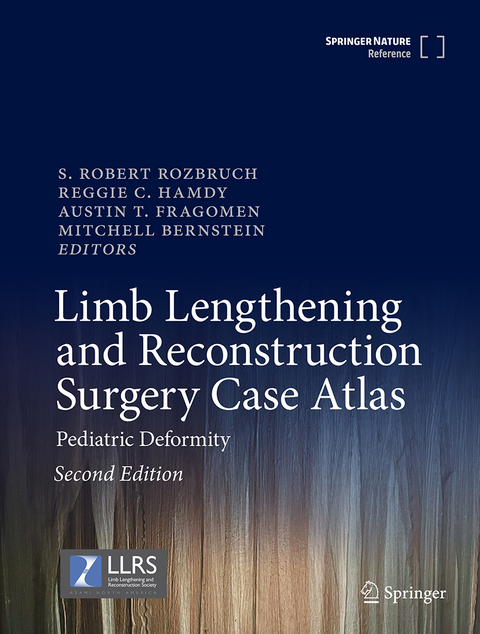 Limb Lengthening and Reconstruction Surgery Case Atlas - 