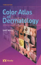 Color Atlas of Dermatology - White, Gary M.