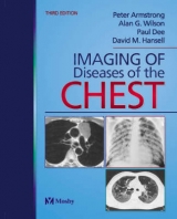 Imaging of Diseases of the Chest - Armstrong, Peter; etc.; Wilson, Alan G.; Dee, Paul; Hansell, David M.