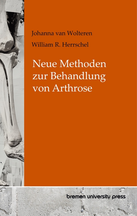 Neue Methoden zur Behandlung von Arthrose - Johanna van Wolteren, William R. Herrschel