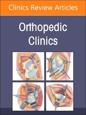 Perioperative Risks in Orthopedics, An Issue of Orthopedic Clinics - 