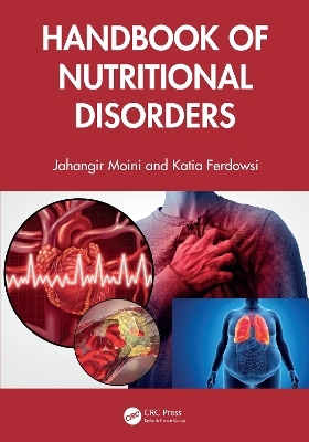 Handbook of Nutritional Disorders - Jahangir Moini, Katia Ferdowsi