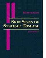 Skin Signs of Systemic Disease - Braverman, Irwin M.