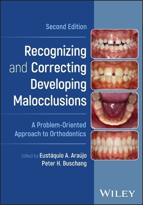 Recognizing and Correcting Developing Malocclusions - 