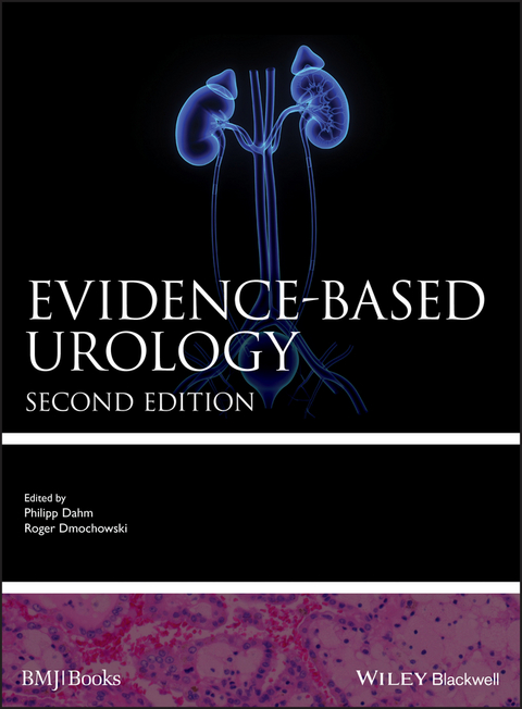 Evidence-based Urology - 