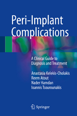 Peri-Implant Complications - Anastasia Kelekis-Cholakis, Reem Atout, Nader Hamdan, Ioannis Tsourounakis