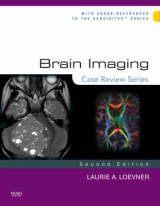 Brain Imaging: Case Review Series - Loevner, Laurie A.