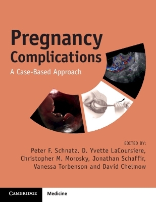 Pregnancy Complications - 