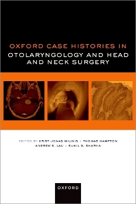 Oxford Case Histories in Otolaryngology and Head and Neck Surgery - Dr Kristijonas Milinis, Dr Thomas Hampton, Dr Andrew S. Lau, Dr Sunil D. Sharma