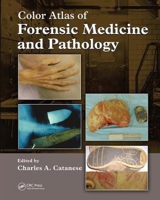 Color Atlas of Forensic Medicine and Pathology - Charles Catanese, Brian Heaton