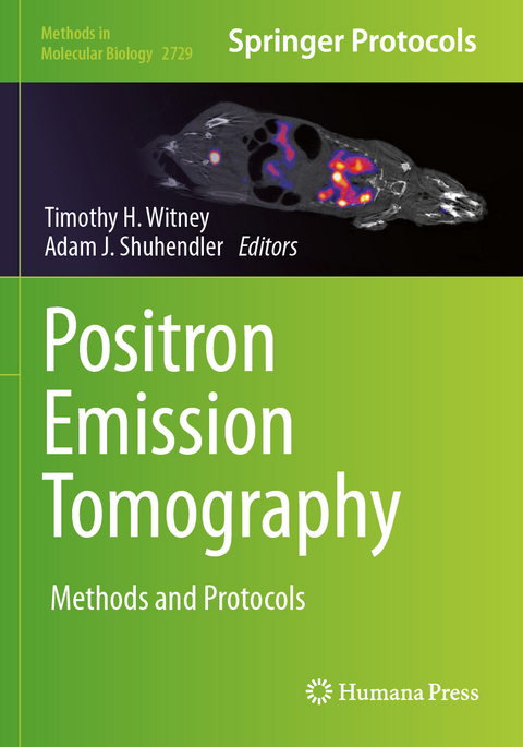 Positron Emission Tomography - 