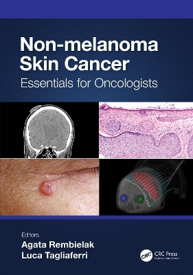 Non-melanoma Skin Cancer - 