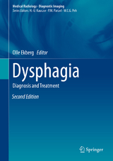 Dysphagia - 