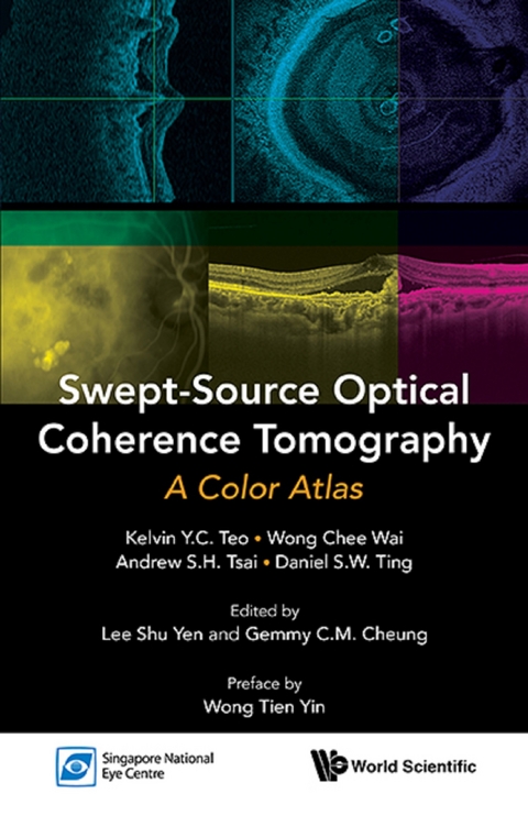 SWEPT-SOURCE OPTICAL COHERENCE TOMOGRAPHY: A COLOR ATLAS - Kelvin Yi Chong Teo, Chee Wai Wong, Andrew Shih Hsiang Tsai, Daniel Shu Wei Ting