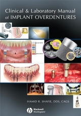 Clinical and Laboratory Manual of Implant Overdentures - Hamid R. Shafie