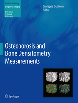 Osteoporosis and Bone Densitometry Measurements - 